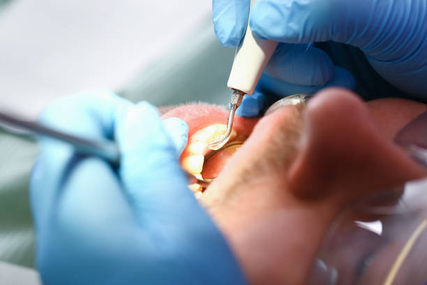 Best Urgent Tooth Repair  in Ohatchee, AL
